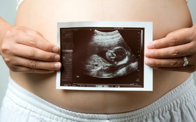 Quais são os direitos trabalhistas da mulher que engravida?